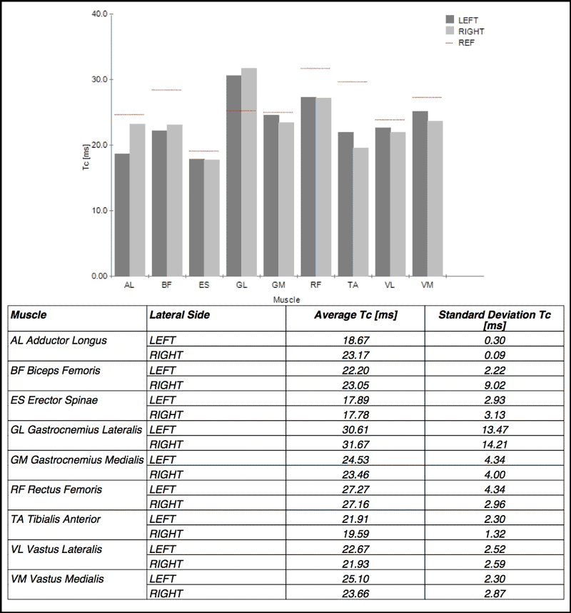 TMG Team Contraction Times