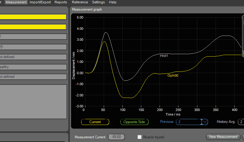 Muscle Tone Plot