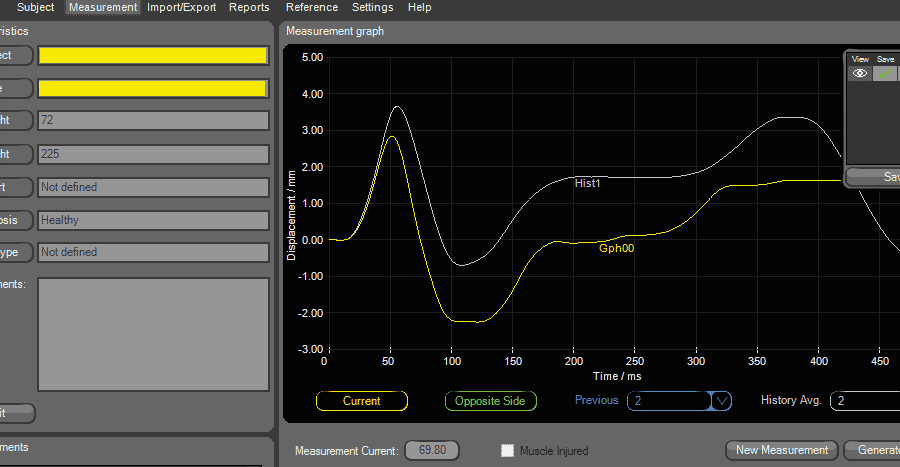 Muscle Tone Plot