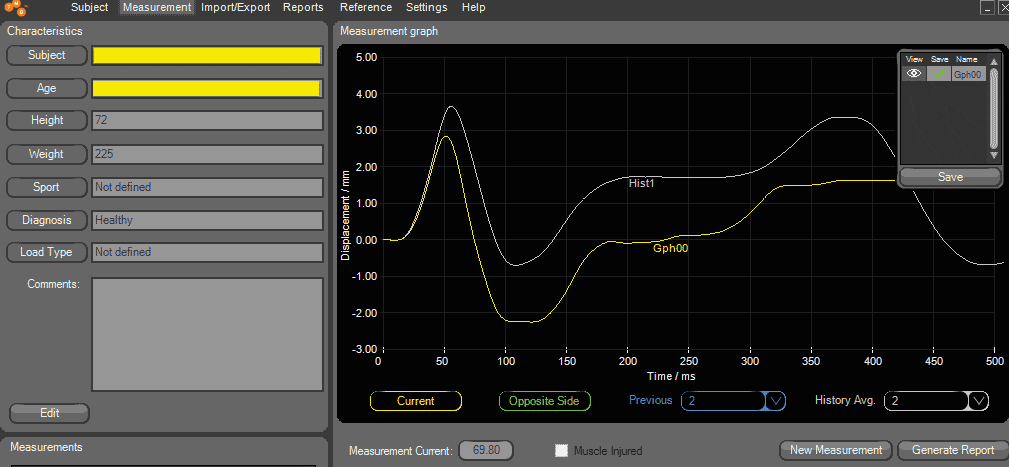 Muscle Tone Plot