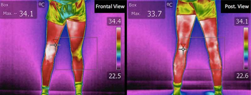 MyoAnalytics Thermography