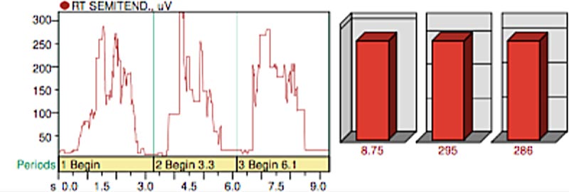 Noraxon Surface EMG