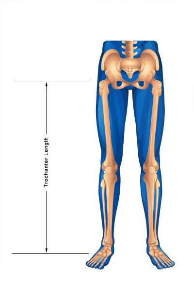 Trochanter Length