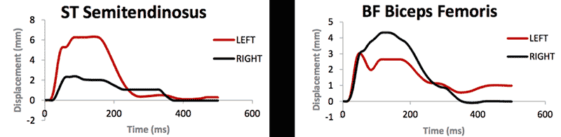 Biceps Femoris