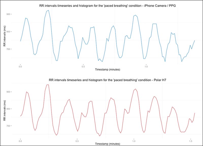 HRV Comparison