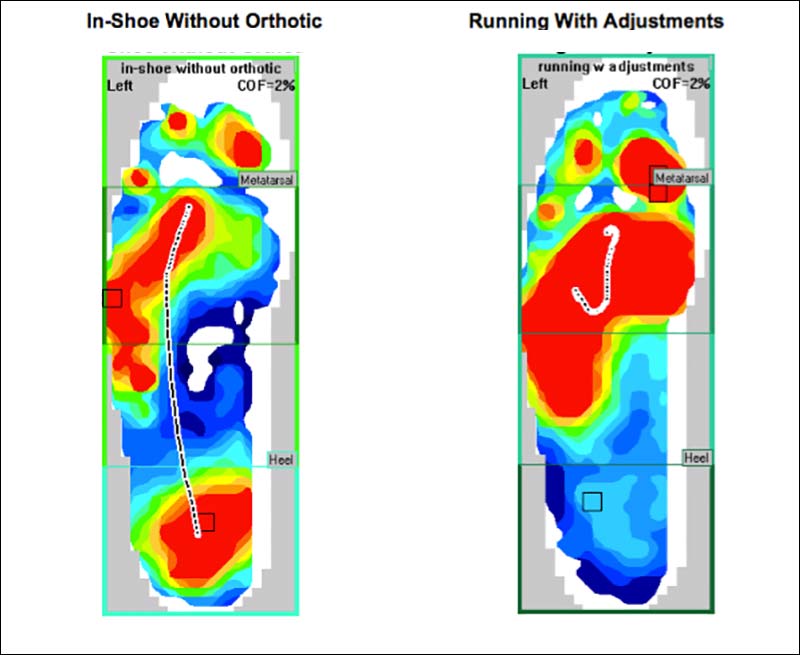 Running with Orthotics